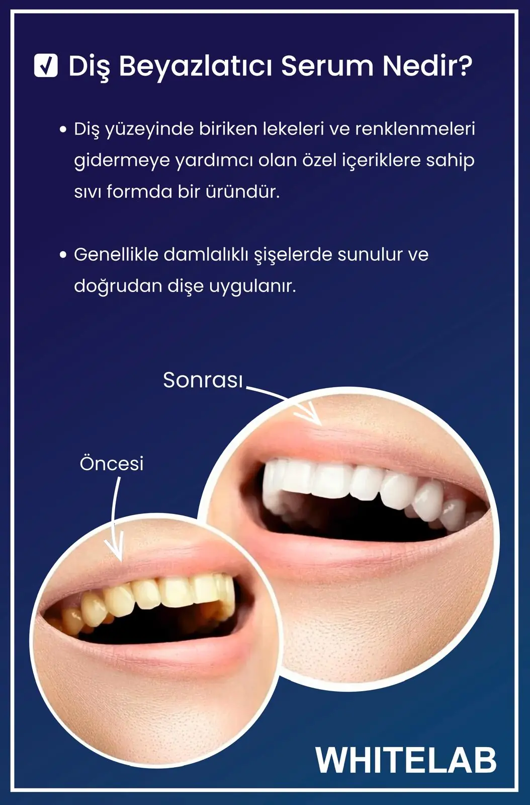 WHİTELAB DİŞ BEYAZLATICI görsel 2